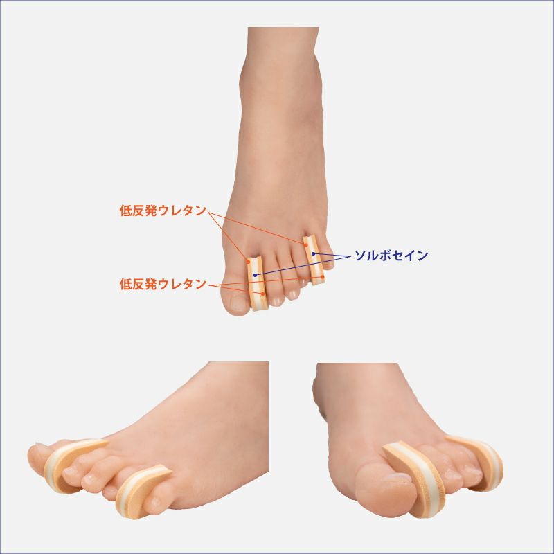 ソルボ足指間パッド